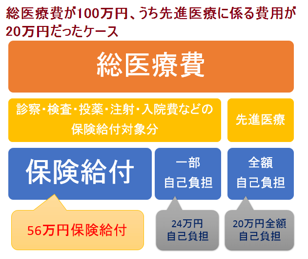 先進医療費用は全額自己負担　保険診療と併用の混合診療と自由診療