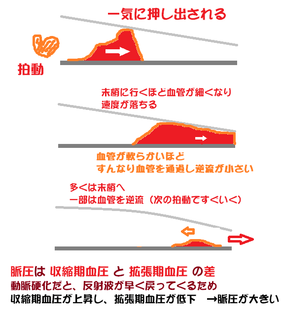 脈圧が大きいと なぜ動脈硬化を疑うのか 理由とメカニズム