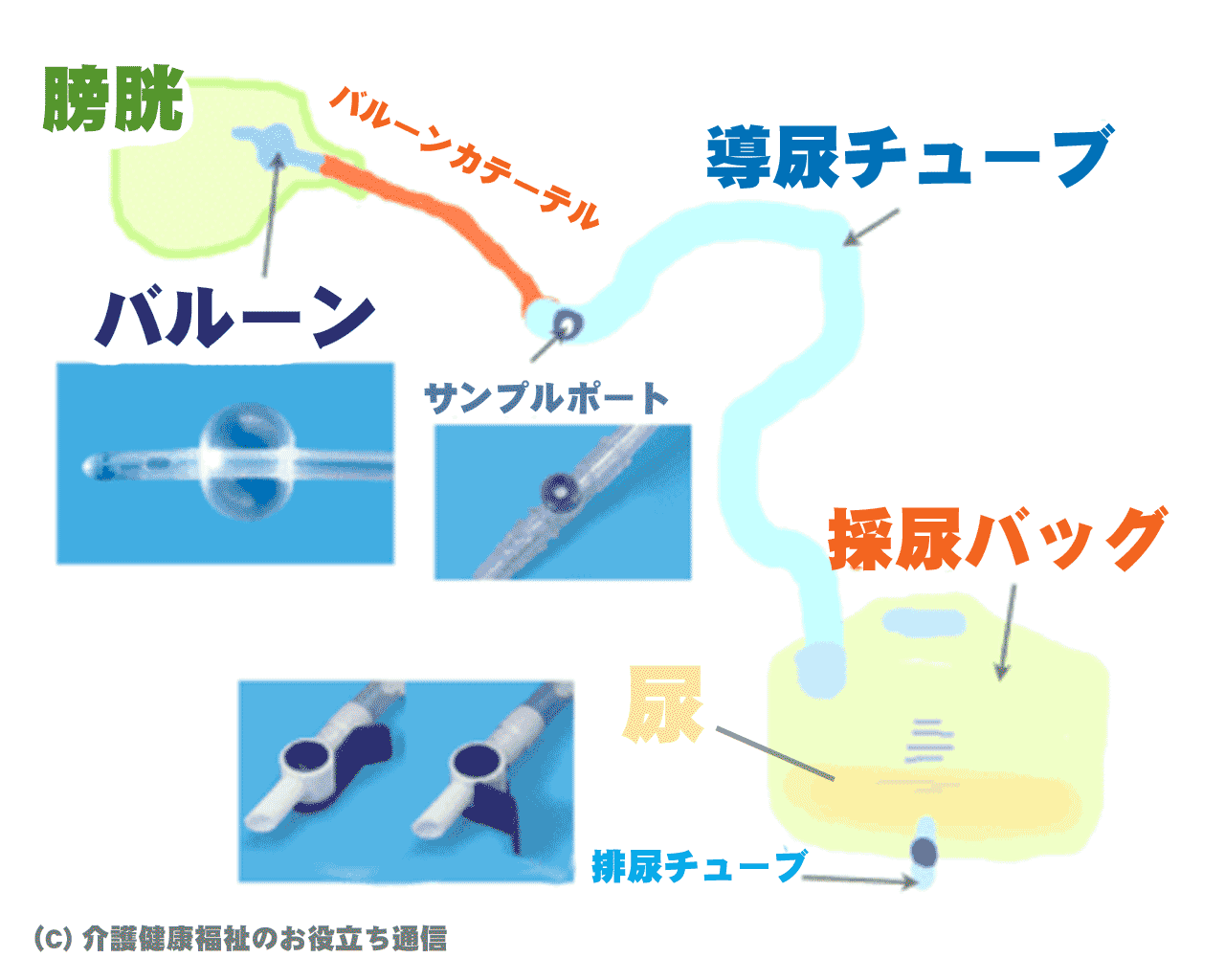 ハルンバッグとは？　ウロ・バルーンなど意味の違いや注意点