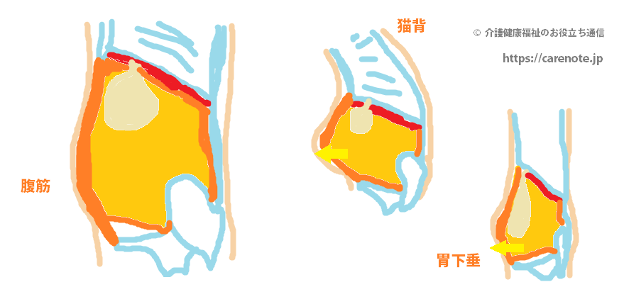 ぽっこりお腹の６つの原因　下腹部のポッコリ姿勢を解消する方法