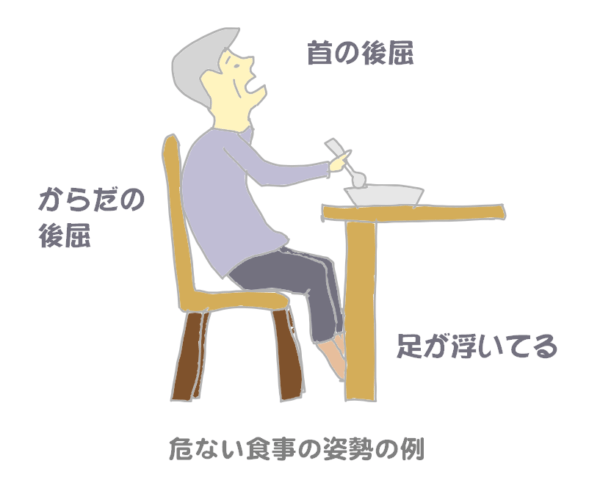 誤嚥しやすい悪い食事姿勢