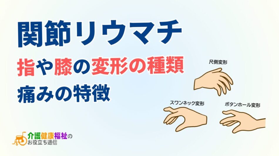 関節リウマチで生じる「手指」や「膝」の変形症状・痛みの種類